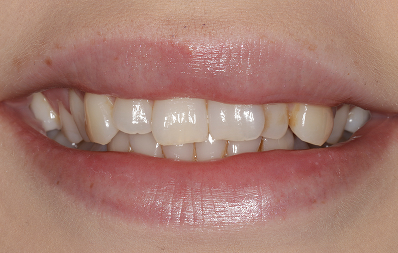 Before - Mill Hill Dental Practice