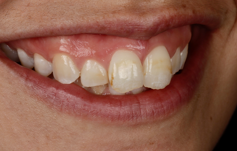 Before - Mill Hill Dental Practice