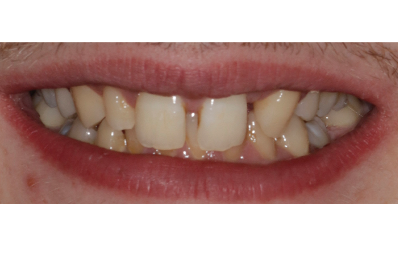 Before - Mill Hill Dental Practice