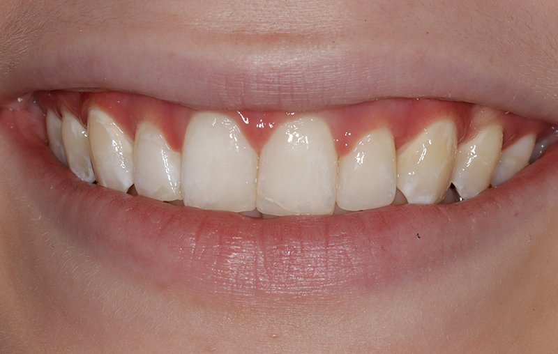 After - Mill Hill Dental Practice