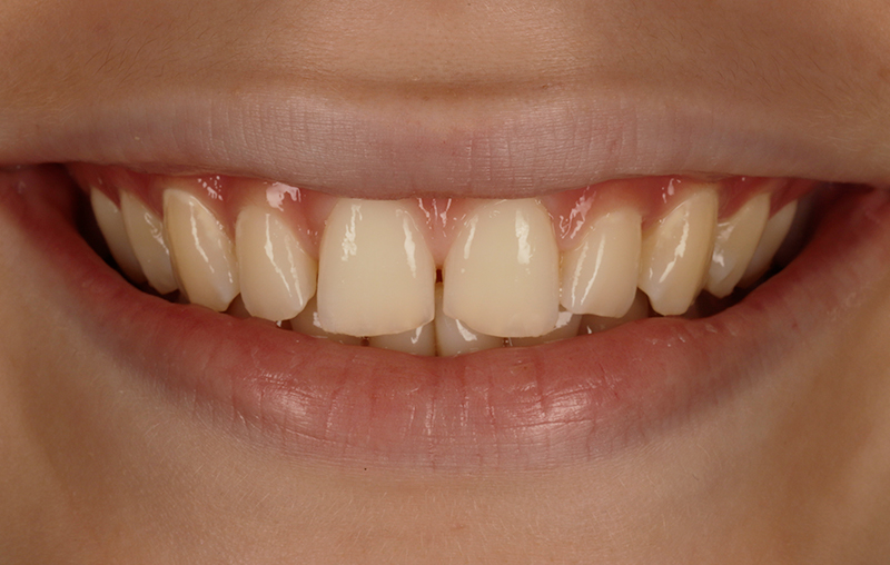 Before - Mill Hill Dental Practice