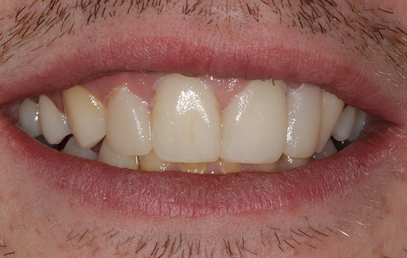 After - Mill Hill Dental Practice