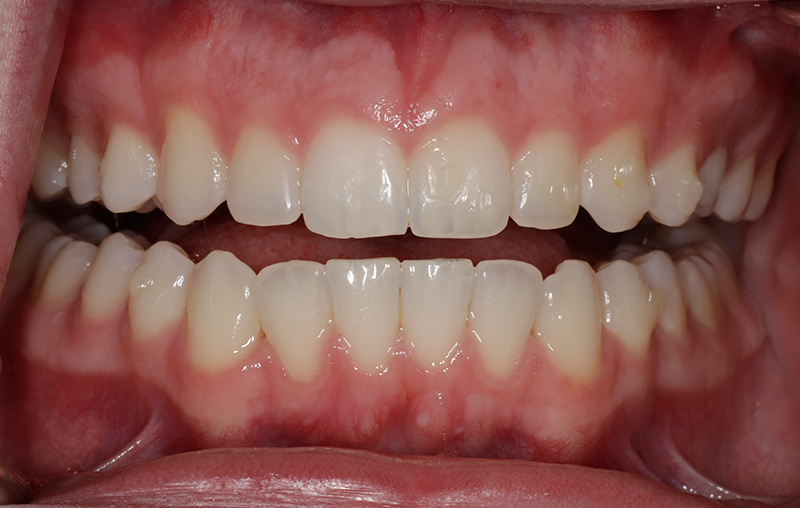 Before - Mill Hill Dental Practice