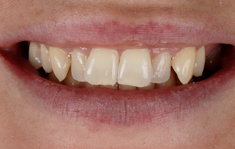 Before - Mill Hill Dental Practice